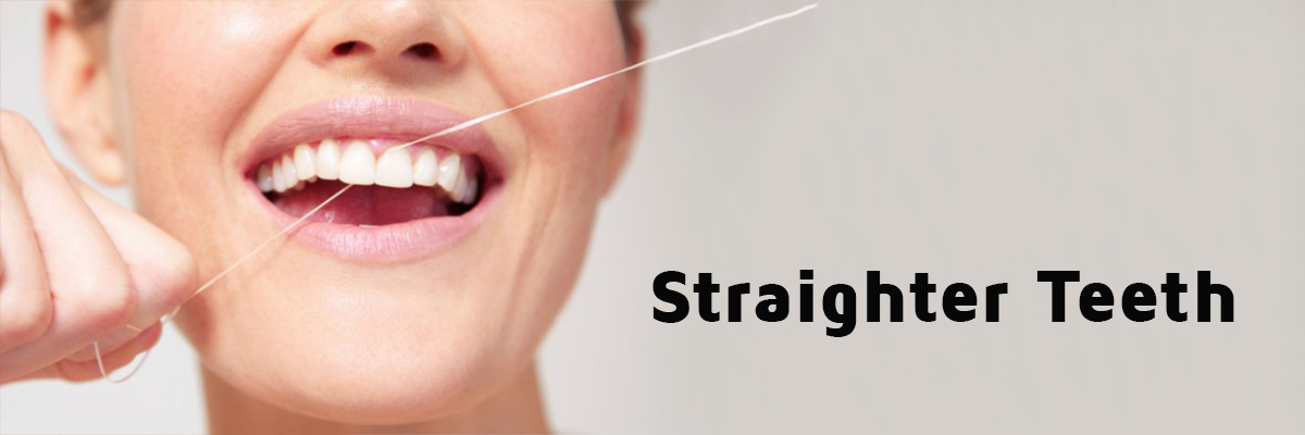 teeth straightening Hounslow